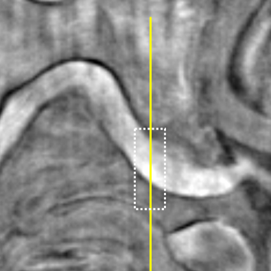 Maximising the Potential of Seismic Expressions